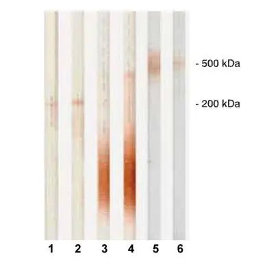 Detection of human PAPP-A and proMBP subunits of htPAPP-A by monoclonal antibodies in Western blot.
